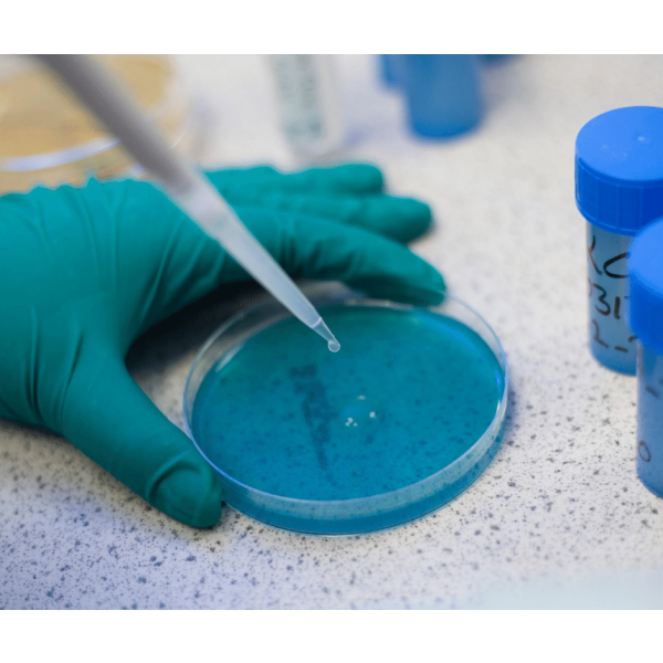 Sample Analysis By Direct Plating 