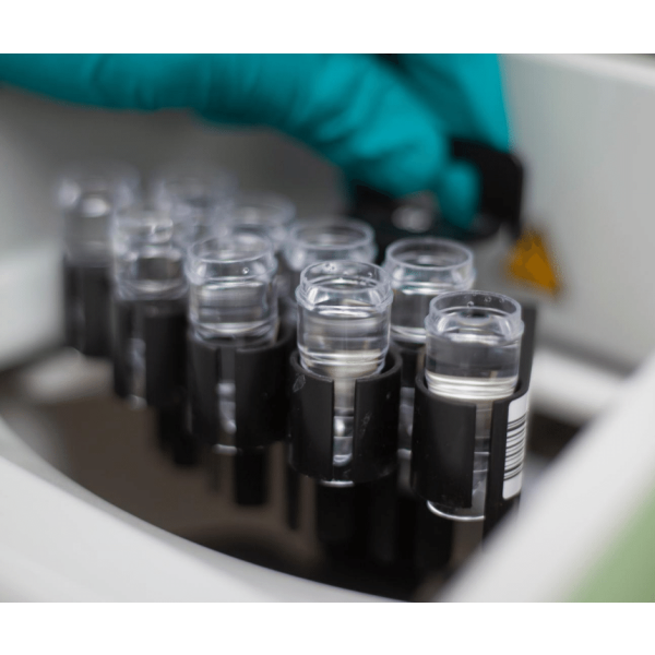 Liquor Analysis Plus Sodium Testing