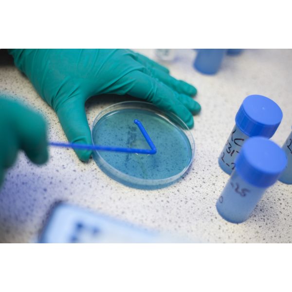 Sample Analysis by Direct Plating 