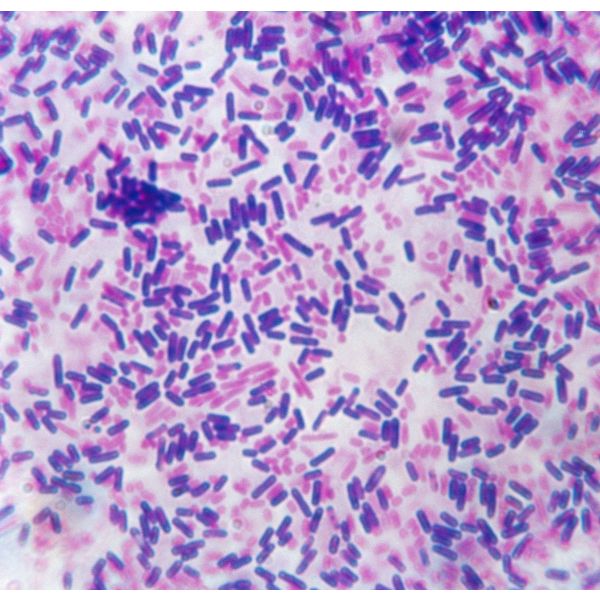 Gram Staining (Per Sample) 