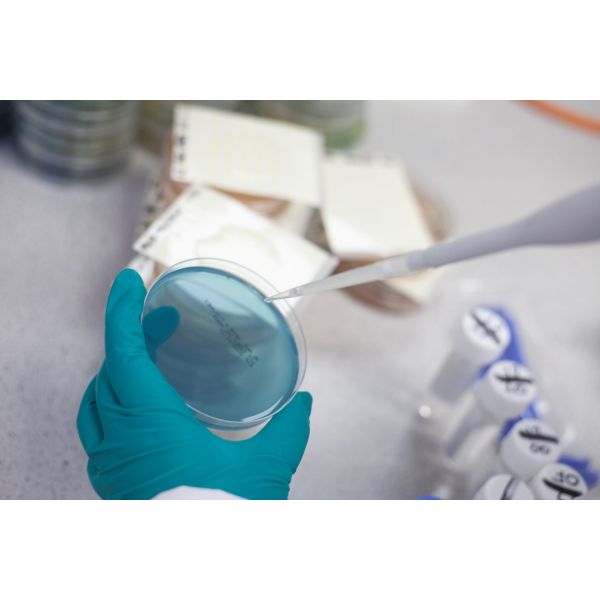 Potassium Sorbate Testing