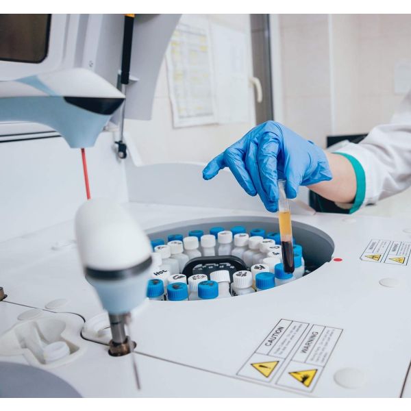 Shelf Life Analysis (Tannometer) 