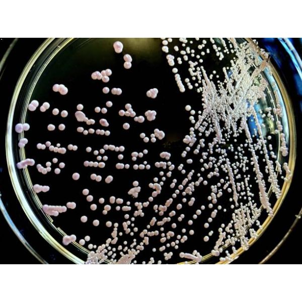 Yeast Culture Supply: Free