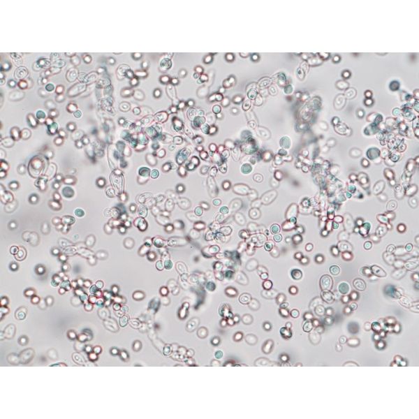 Yeast Identification DNA 