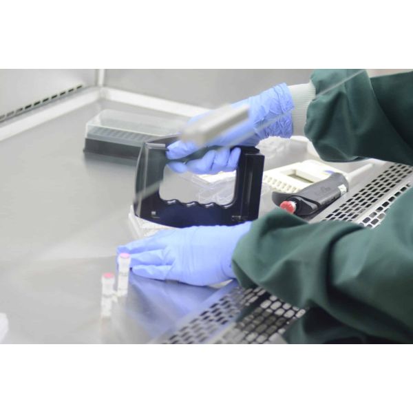 Yeast Identification Services PCR 