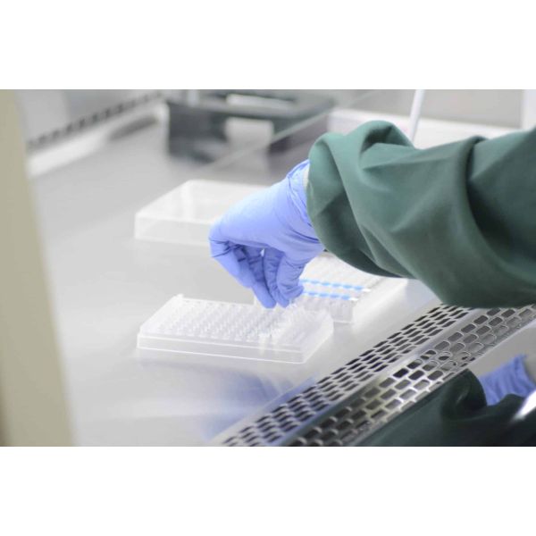 Yeast Contamination Analysis